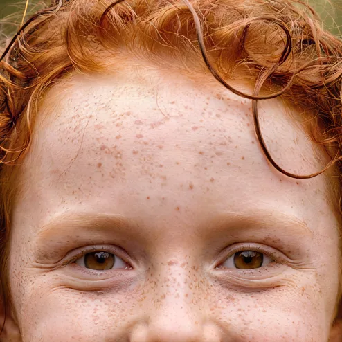 Freckled red-haired girl in a yellow raincoat, upscaled 4× with AI, 100% crop