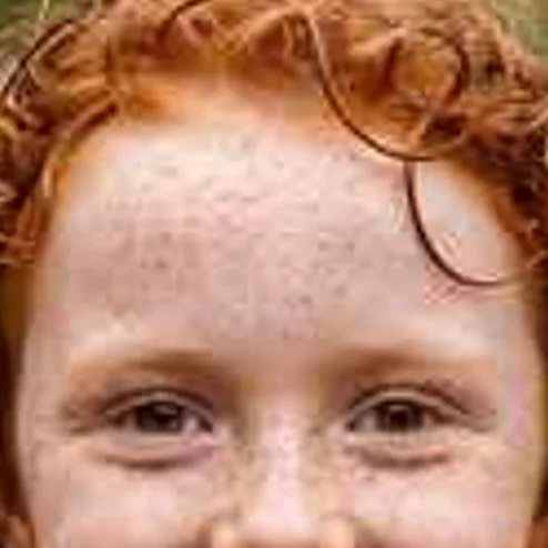 Freckled red-haired girl in a yellow raincoat, low-resolution original, 100% crop